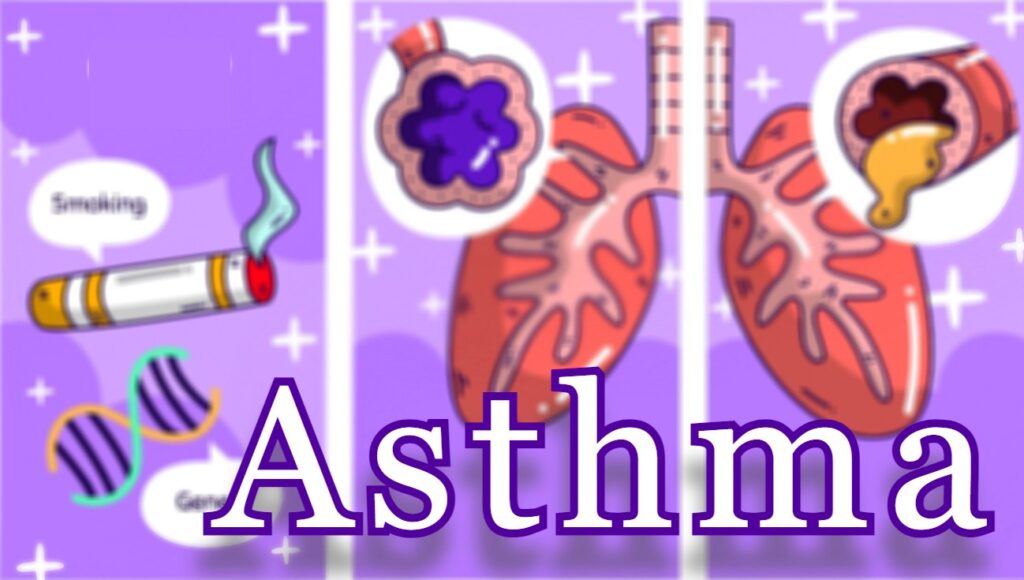 Illustration: Factors contributing to asthma